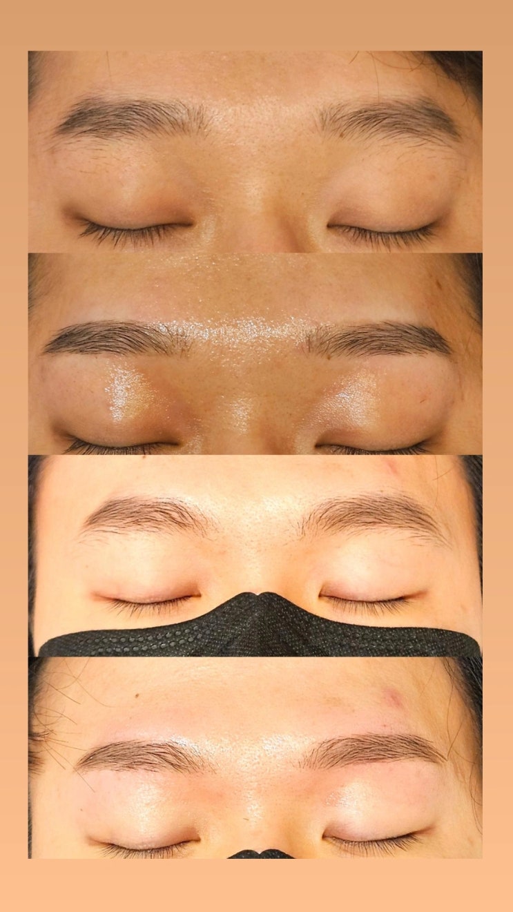  남자 눈썹 왁싱, 눈썹을 뽑았는데 더 짙어질 수 있다. 영등포 남자 왁싱샵 "청춘케어"