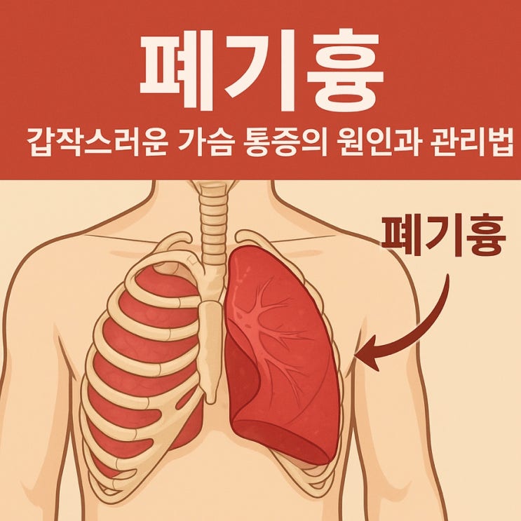   폐기흉(Spontaneous Pneumothorax): 갑작스러운 가슴 통증의 원인과 관리법