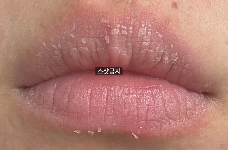 롬앤 더 쥬시 래스팅 틴트 회수 및 환불 후기 with 구순염_립밤, 연고 추천