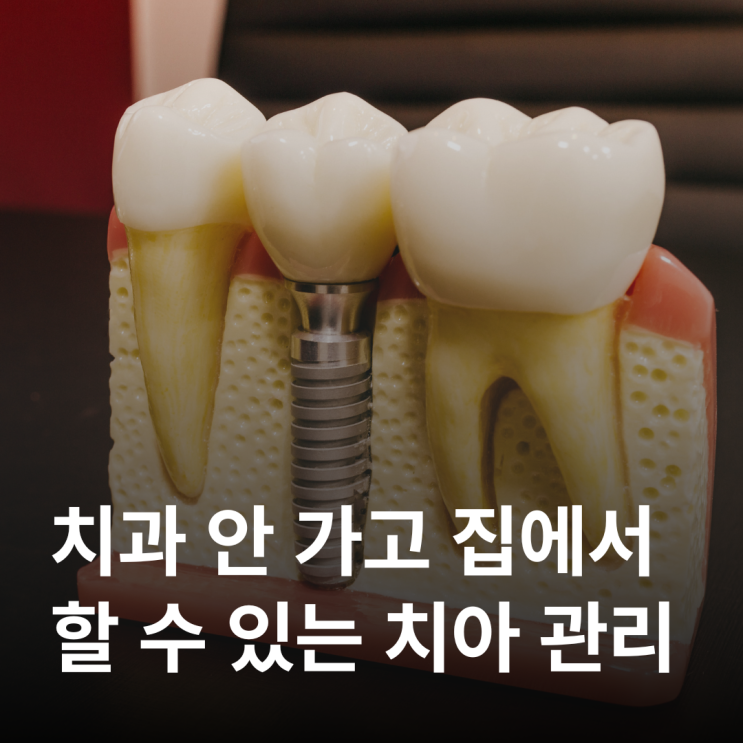  치과 안 가고 집에서 치아 관리하는 꿀팁