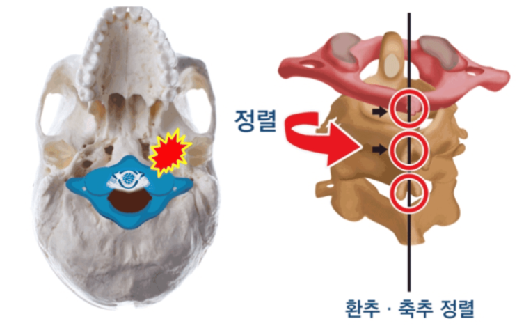  만성 통증의 원인, '이곳'에 있을지 모릅니다