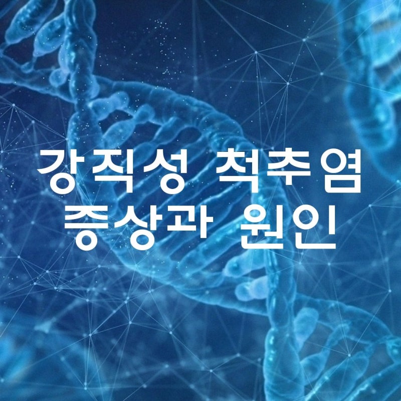 강직성 척추염(feat. 배우 이동건 희귀병)원인 증상 병원 명의 진단 치료