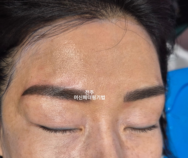 송천동눈썹문신 잔흔제거 안하고 반영구 해결했을때!