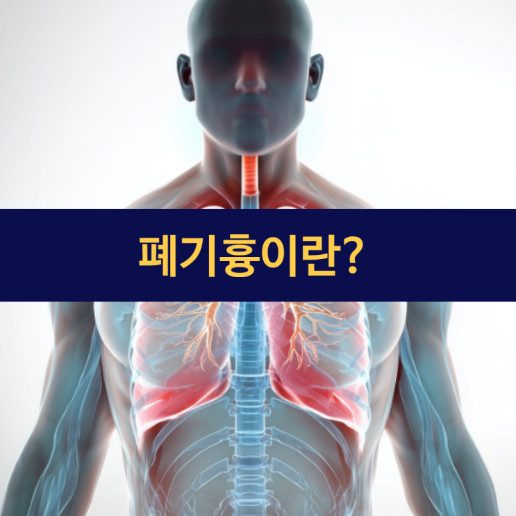  폐기흉 | 폐기흉 뜻 | 원인 증상 치료 사망 | 갑작스런 가슴 통증과 호흡곤란