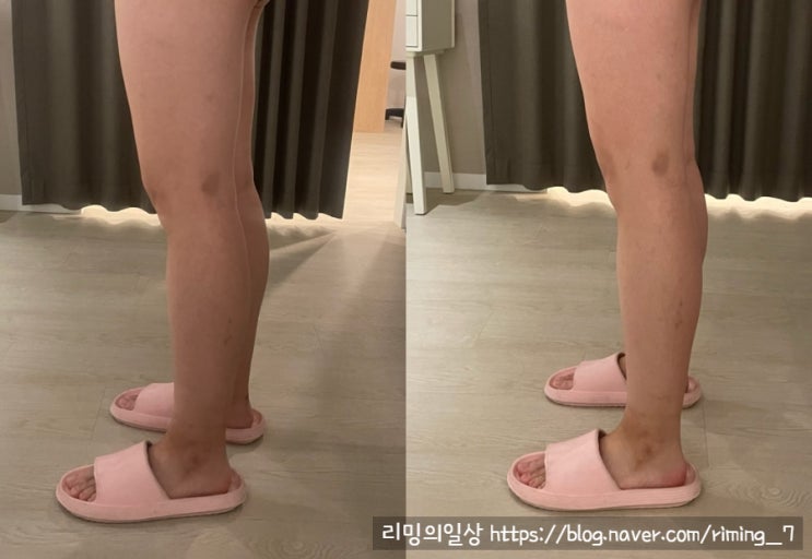  정관마사지 기장 고은미학 에스테틱