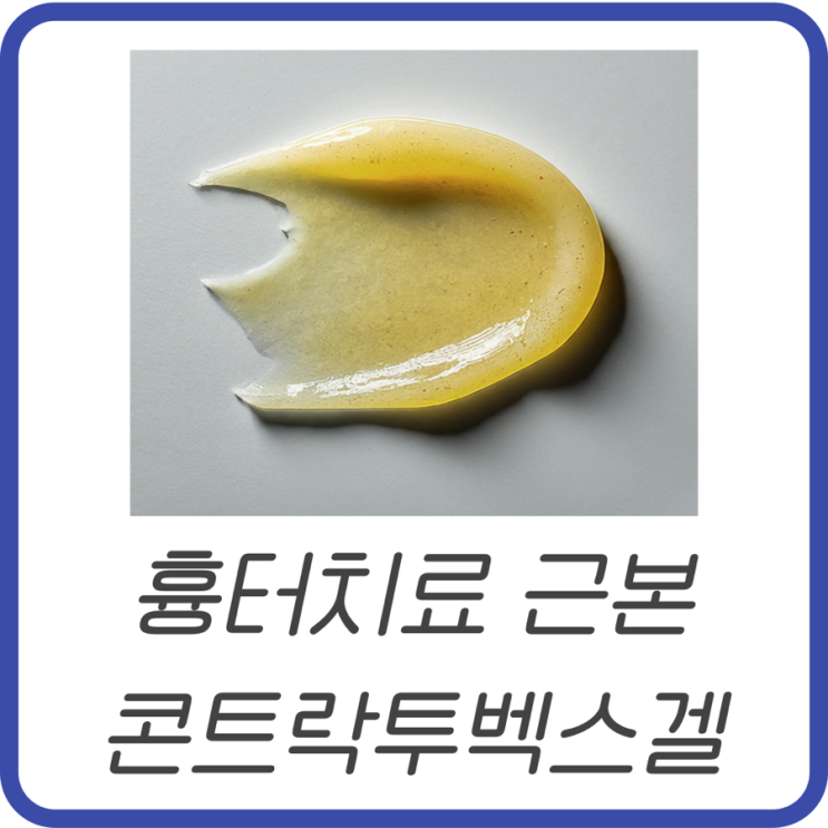 콘투락투벡스겔 가격, 부작용과 사용법 | 흉터치료 꿀정보