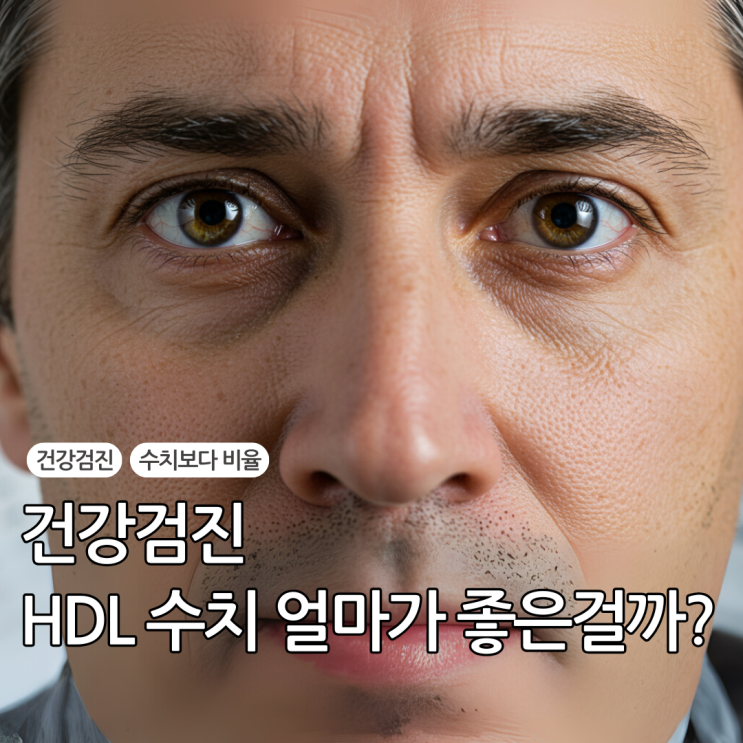  HDL콜레스테롤높으면 좋기만 할까? 더 중요한건 비율입니다.