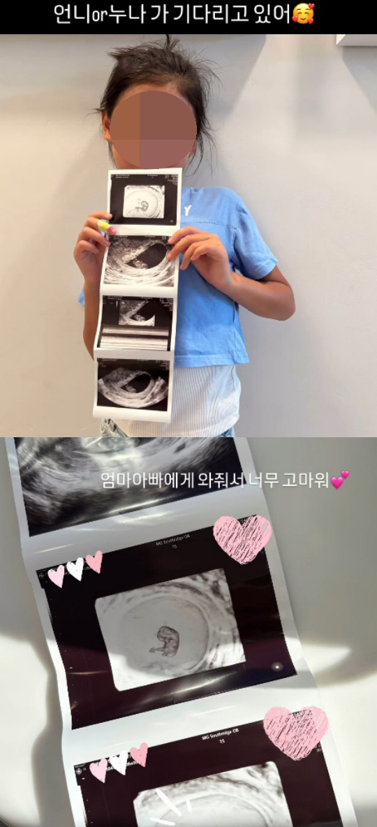  혜박, 결혼 17년 만에 둘째 소식  “두 번의 아픔 뒤 찾아온 기적”