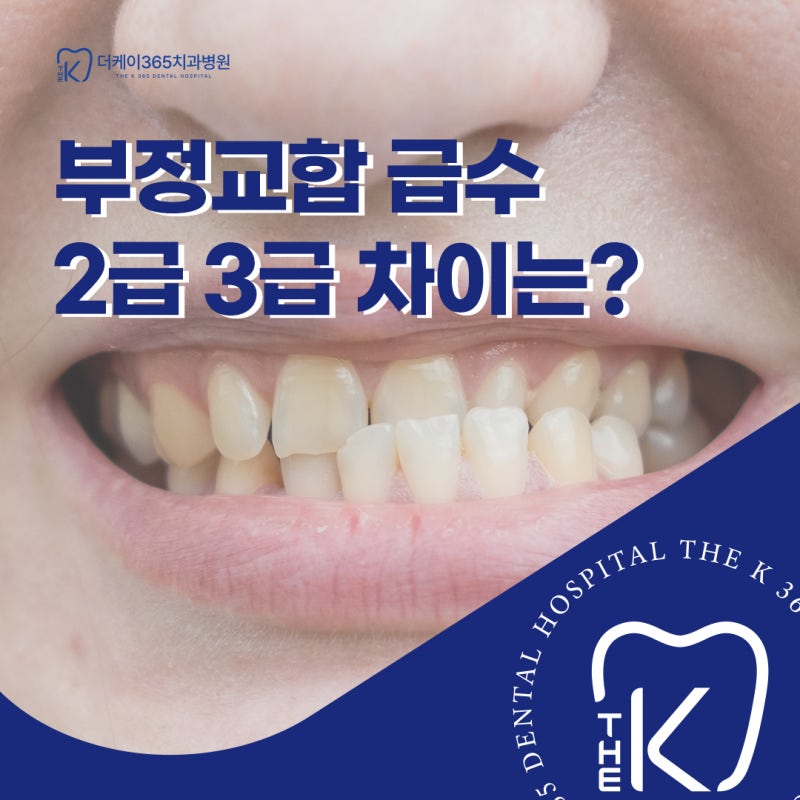 갈산동치과 부정교합 급수 2급 3급 차이는?