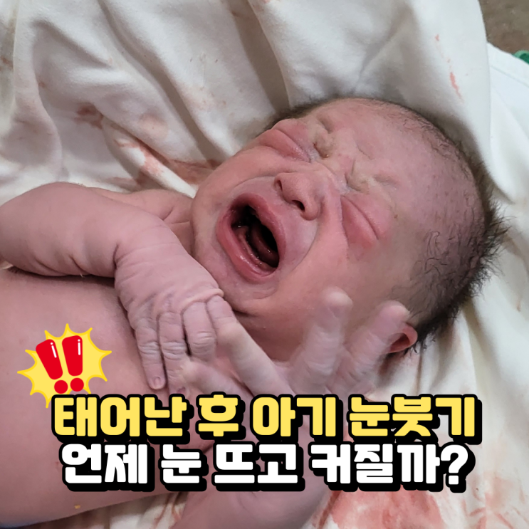  아기눈붓기, 신생아 눈뜨는시기와 눈크기 눈초점 변화 정리