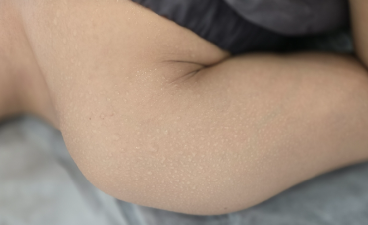  임산부 출산후 붓기 완화 대전 괴정동 바디관리 에르벨 에스테틱 온열찜질기 전신순환케어