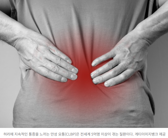  “대마초 추출물, 중독 없이 만성 허리 통증 완화 차세대 진통제 가능성”