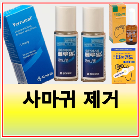 사마귀 제거제 베루말액 약 처방 사용법 가격