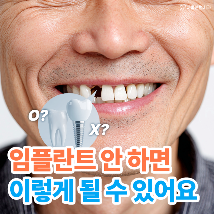  임플란트 안하면 추후 이런 결과가 발생할지도