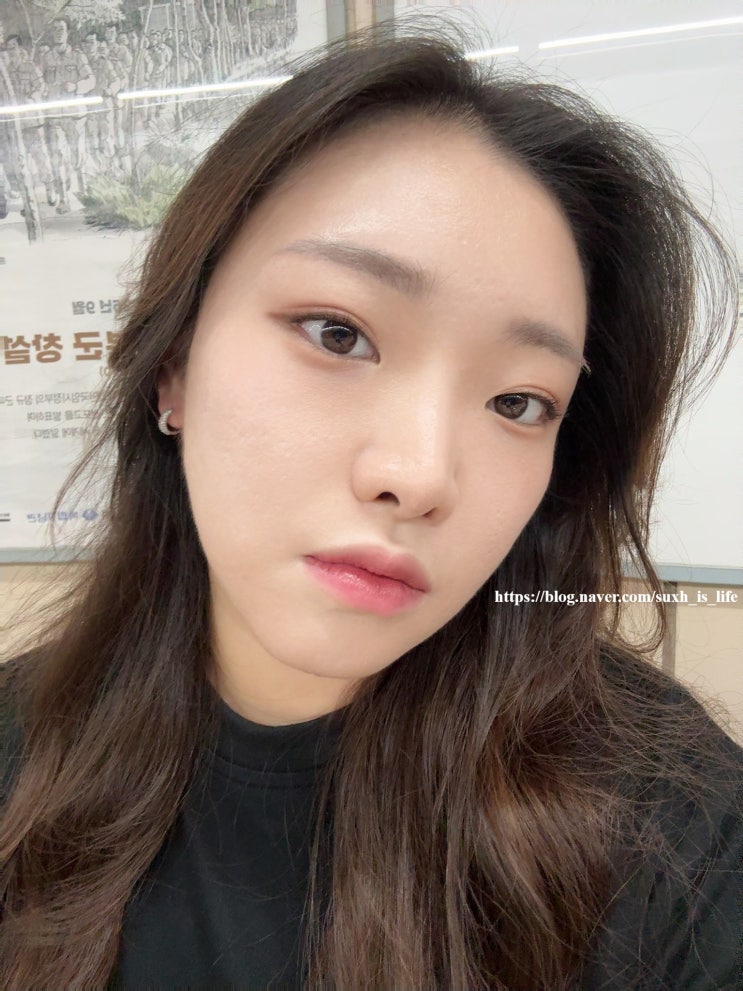  신사역 성형외과 텐써마 고현정 리프팅 600샷 당일 2주 효과 유지기간