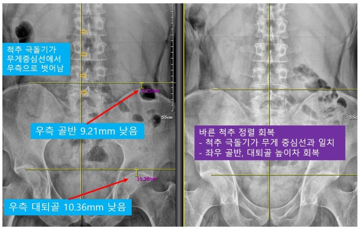  Dr Lee를 찾아주시는 분들에게 드리는 6가지 이야기 - 이경무 대표원장