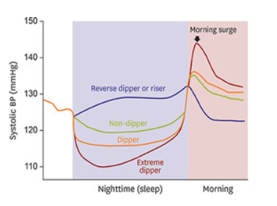  24시간 혈압 검사 방법, 주의사항, 결과(dipper/non-dipper/riser/extreme dipper)
