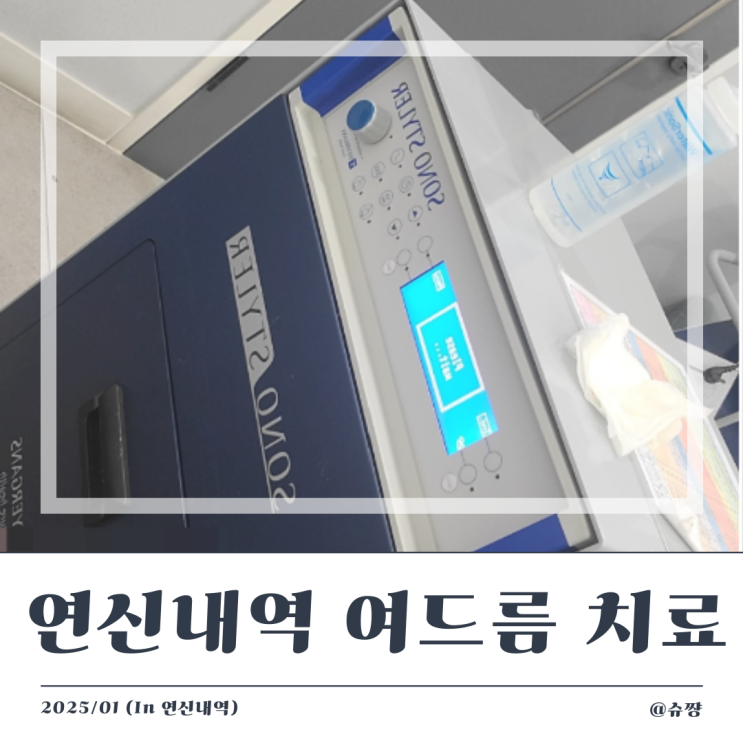  [연신내역 피부과]내 돈 내산 ⑨ 여드름 치료 (아그네스 레이저, 브이빔, 소노스타일러)