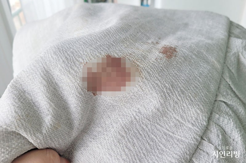이불 핏자국 생리혈 지우기 피얼룩제거 세탁기 가능해요