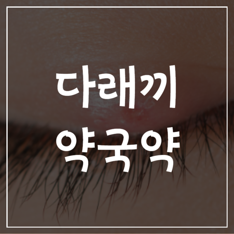 눈 다래끼 약국 약 안약 병원 전염