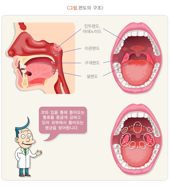 편도가 부었어요! 목이 아파요!