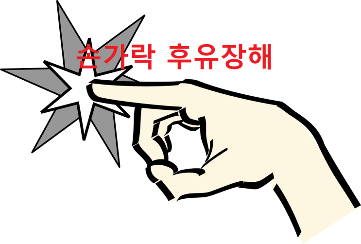  엄지손가락 힘줄파열로 인한 후유장해 보상사례