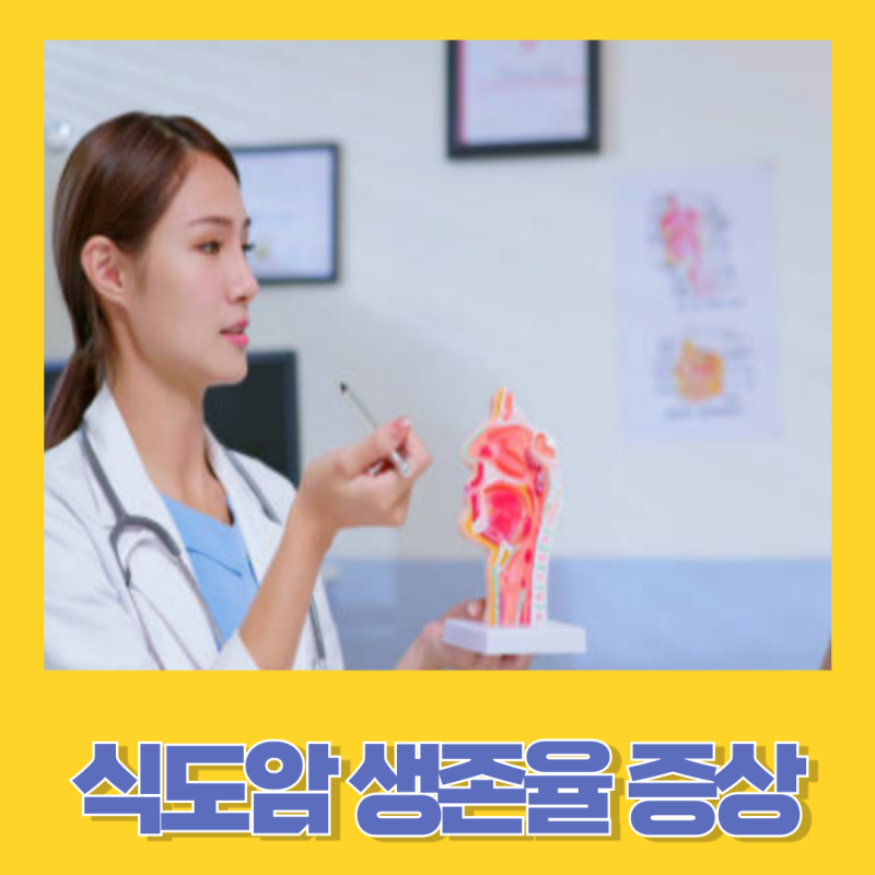 식도암 생존율과 증상 치료방법 알아보기