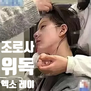  조로사 위독, 엑소 레이 간호중 웨이보 속보