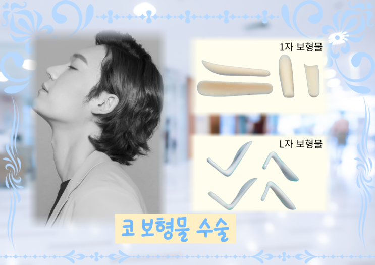  보형물을 이용한 코 성형의 장점과 단점