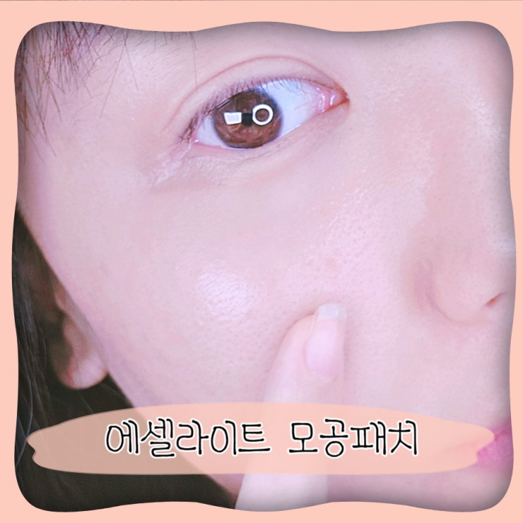  나비존 모공관리 모공패치 에셀라이트 센텔라 포어리스