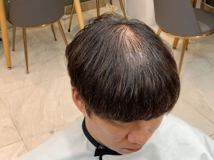  대구 숱없는머리 커버 링거펌 미용실