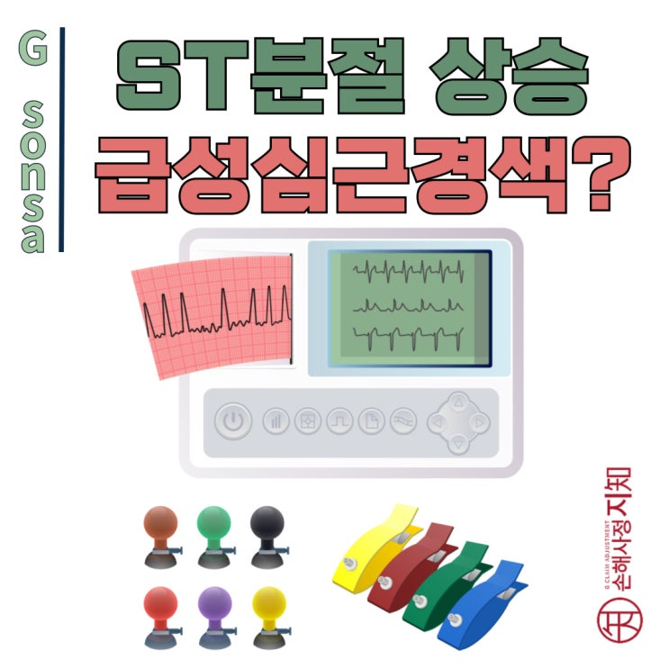  심전도 ST 분절 상승, 과연 급성심근경색일까? 변이형협심증일까? - [아빠의 질병, 1부]