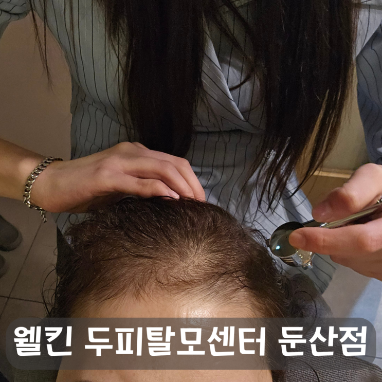 꼼꼼한 대전두피관리로 탈모예방!웰킨 두피탈모센터 둔산점
