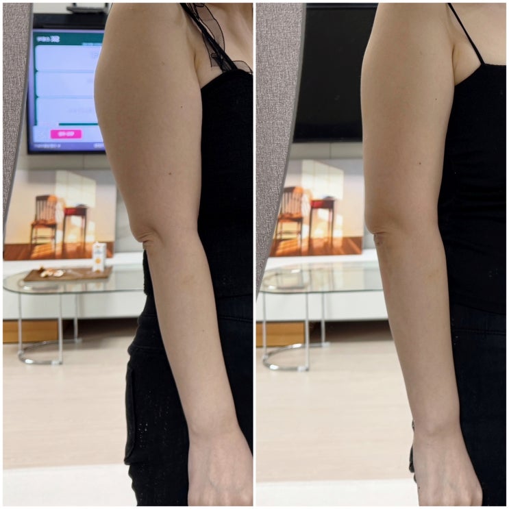 부산 서면 지방분해 주사 하나만 하는 전문 클리닉에서 신부관리 부산 서면 지방분해 주사 하나만 하는 전문 클리닉에서 신부관리