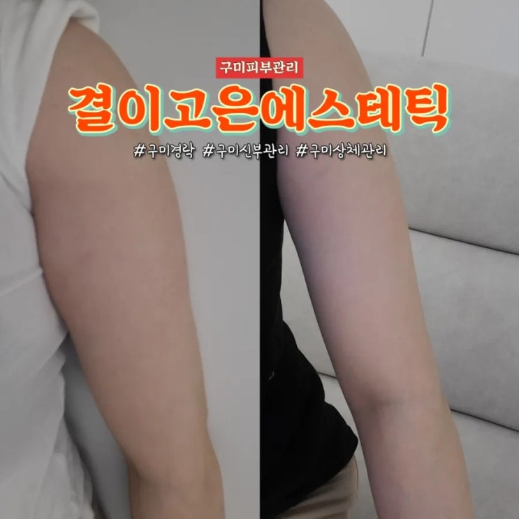 구미경락 결이고은 상체관리 후기 전후사진있음