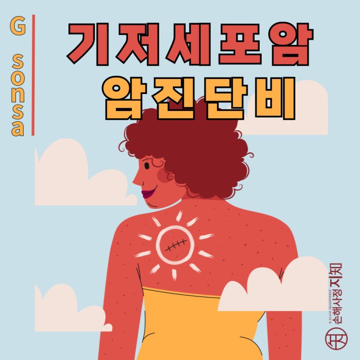  햇빛이 만든 피부암, 기저세포암의 모든 것 - [피부암 보상법, 2부]