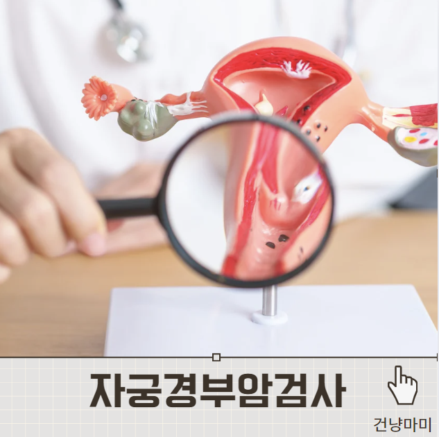 자궁경부암 검사 전 피해야 할 것과 검사 후 반응성 세포 변화 소견