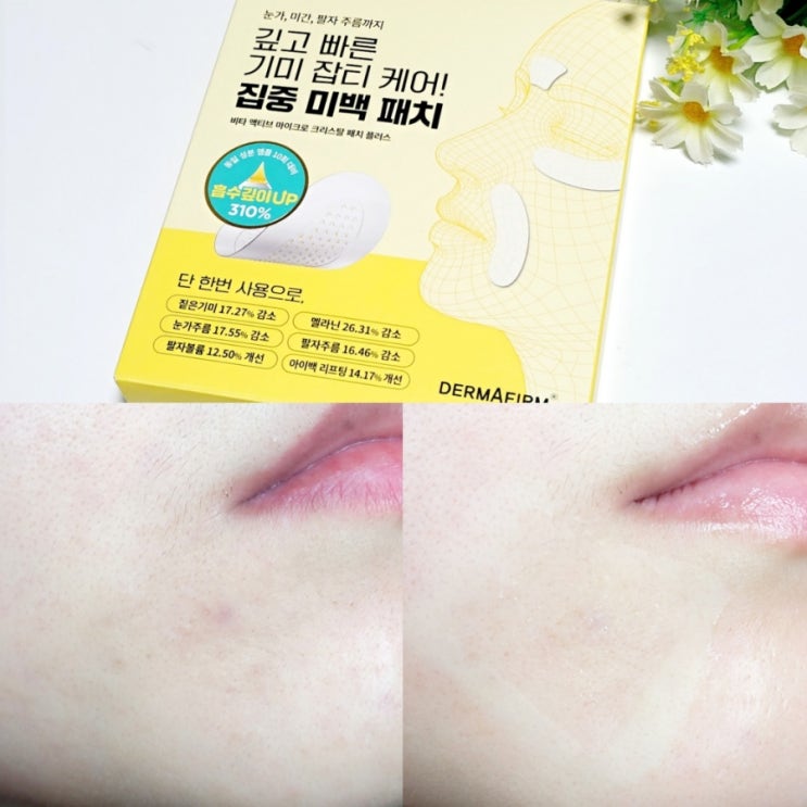  1월 올영픽 더마펌 기미패치 강추, 미백효과까지