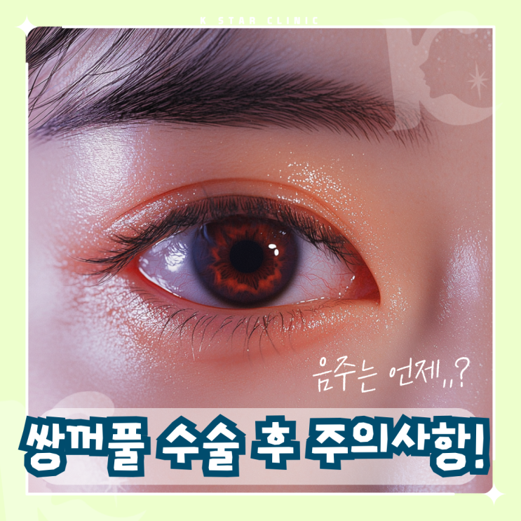  쌍꺼풀수술 후 주의사항, 음주 가능 시기는
