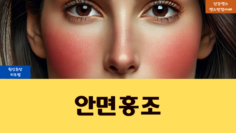 안면홍조 원인 및 증상과 치료법
