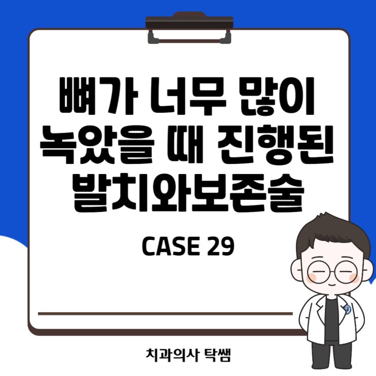  [탁쌤 CASE 29] 청주 치과 뼈가 많이 녹았을 때 진행하는 발치와 보존술