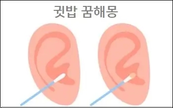  귓밥꿈 귓밥 꿈해몽 귓밥파는꿈 귓밥나오는꿈 참고하세요