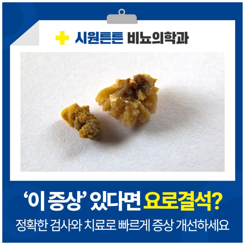 대전 요로결석 '이 증상' 있다면 의심해 봐야