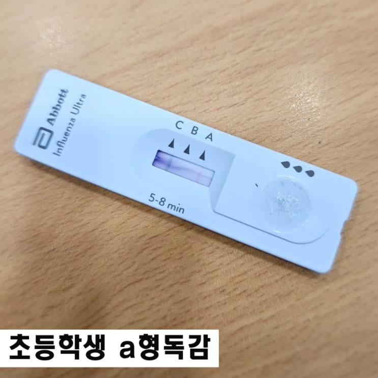  구미 산동옥계아동병원 초등학생 a형독감 검사비용 접수시간
