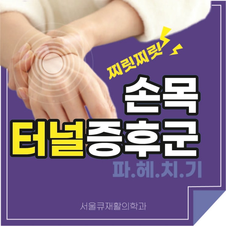  송파역손목통증 자가검사법으로 조기 발견하기