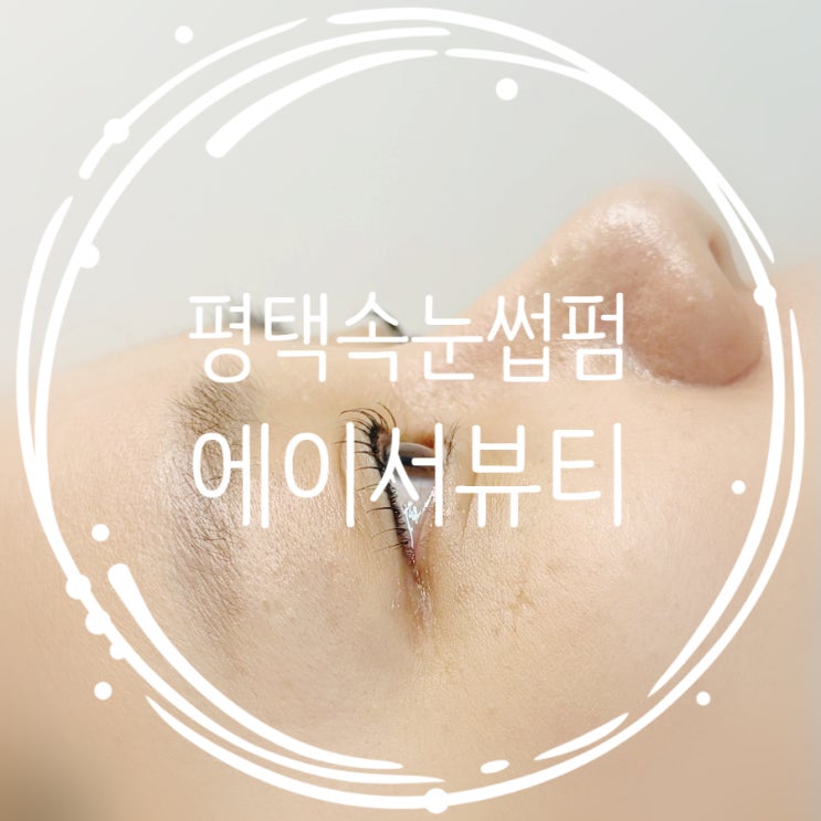  비전동 속눈썹펌 에이서뷰티 쳐지고 짧은 속눈썹도 자연스럽고 또렷하게!