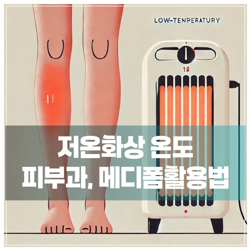 저온화상, 어떻게 대처해야 할까요? 피부과 치료와 메디폼 활용법