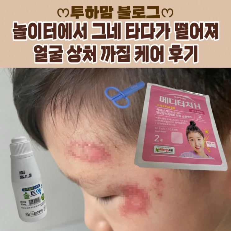  놀이터에서 그네 타다가 떨어져 얼굴 상처 까짐 케어 후기 (소독액, 밴드, 연고)