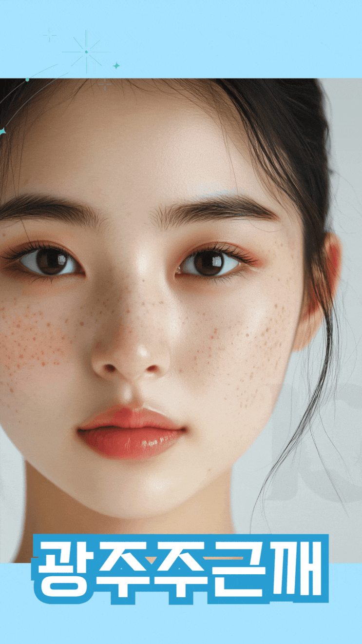  광주 주근깨 수완지구에서 제거하고 싶다면 레이저토닝부터 알아보자