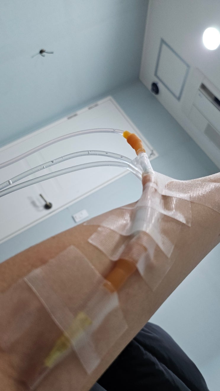  a형독감증상과 비용  어지러움 울렁거림 처방약 코미플루 수액